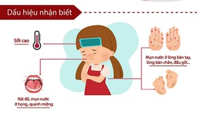 Tăng cường phòng, chống bệnh tay chân miệng