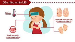 Tăng cường phòng, chống bệnh tay chân miệng